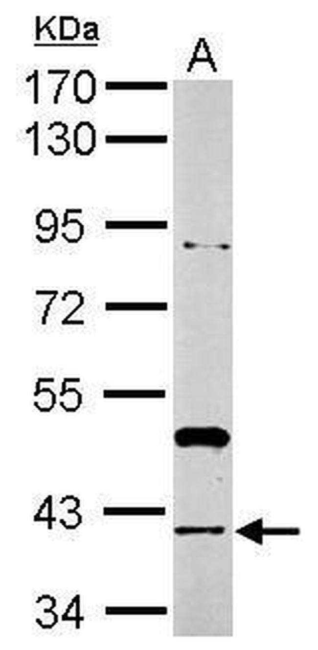 RAD51 Antibody in Western Blot (WB)