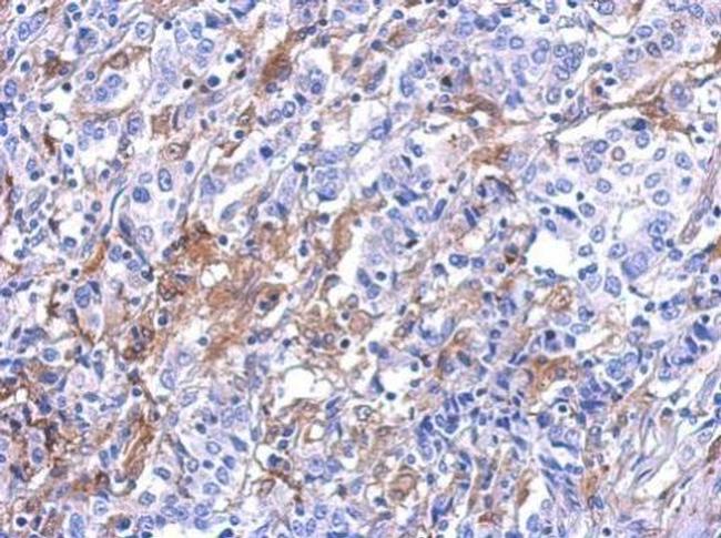 Galectin 3 Antibody in Immunohistochemistry (Paraffin) (IHC (P))