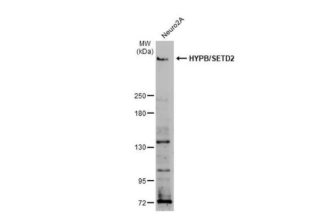 SETD2 Antibody in Western Blot (WB)