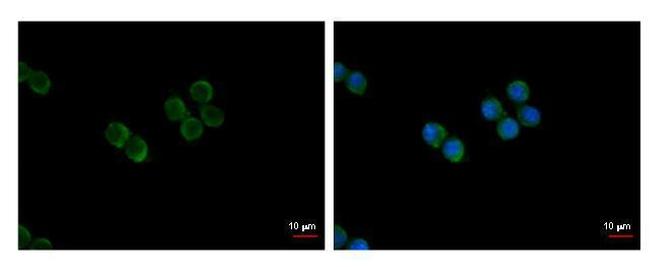 NFATC2 Antibody in Immunocytochemistry (ICC/IF)