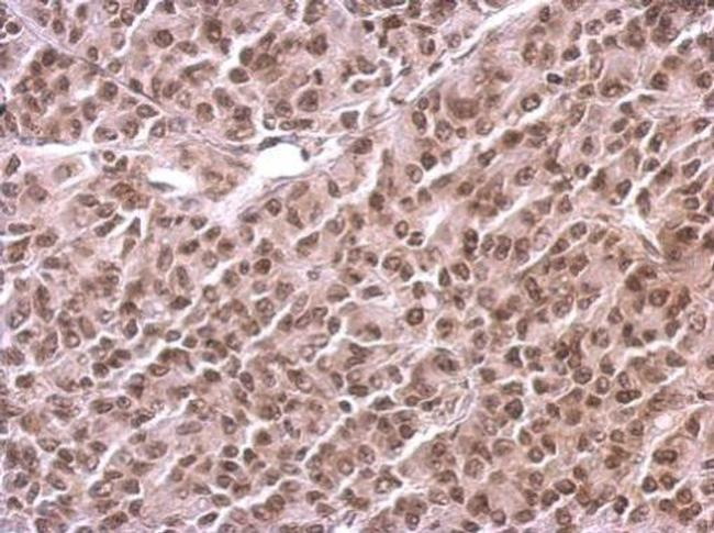 Histone H3 Antibody in Immunohistochemistry (Paraffin) (IHC (P))