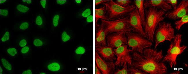 CFDP1 Antibody in Immunocytochemistry (ICC/IF)