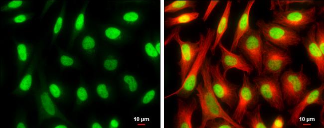 CFDP1 Antibody in Immunocytochemistry (ICC/IF)