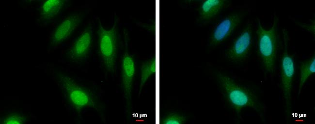 CFDP1 Antibody in Immunocytochemistry (ICC/IF)