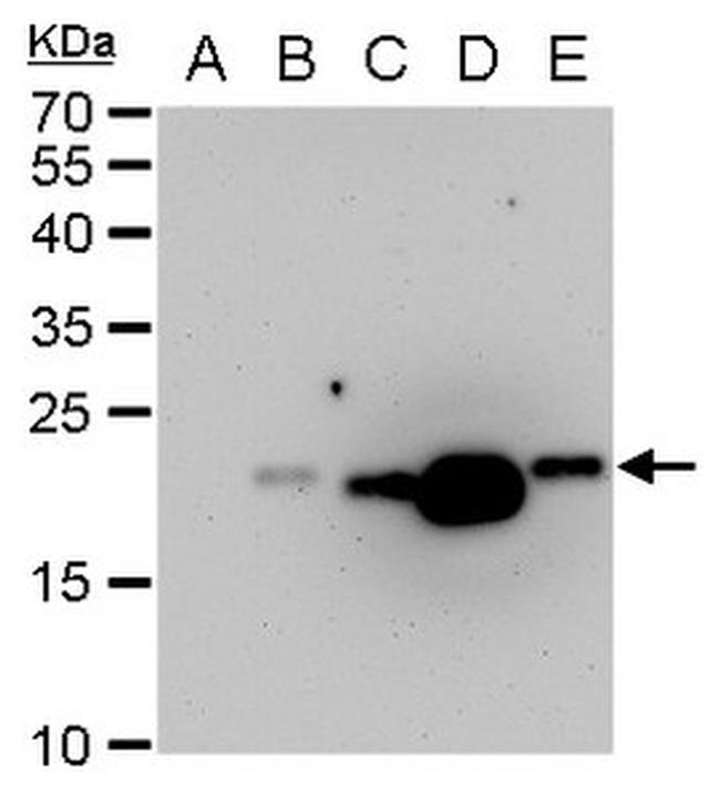 Dengue Virus Type 2 PrM Antibody in Western Blot (WB)