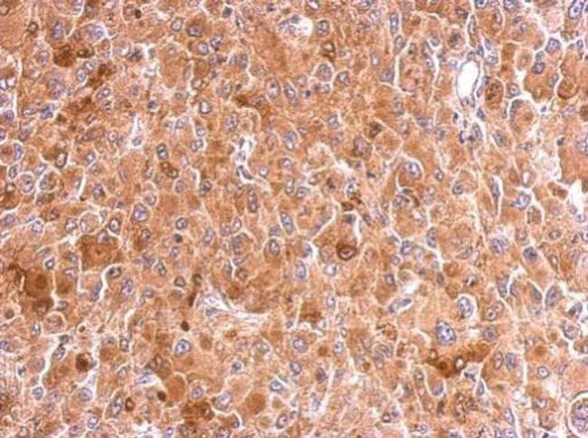 ATG14 Antibody in Immunohistochemistry (Paraffin) (IHC (P))