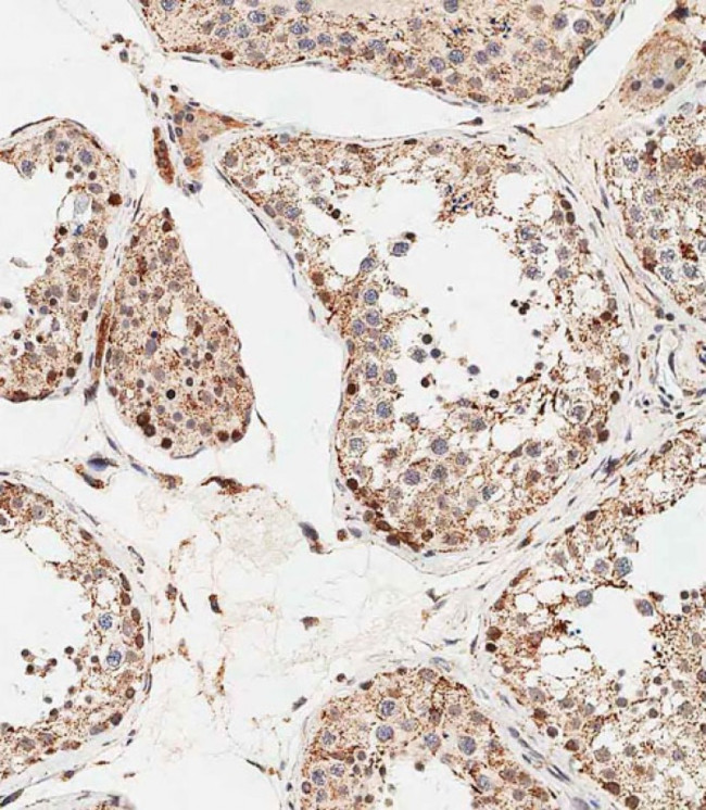 STRA8 Antibody in Immunohistochemistry (Paraffin) (IHC (P))