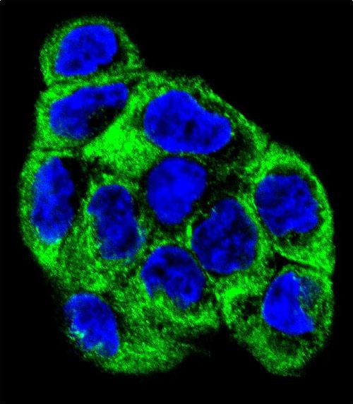 ATP6V1B1 Antibody in Immunocytochemistry (ICC/IF)