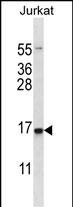 CHOP Antibody in Western Blot (WB)