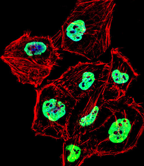 hnRNP D Antibody in Immunocytochemistry (ICC/IF)