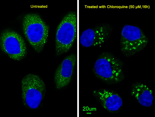 LC3B Antibody in Immunocytochemistry (ICC/IF)