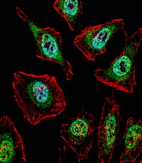 TFE3 Antibody in Immunocytochemistry (ICC/IF)