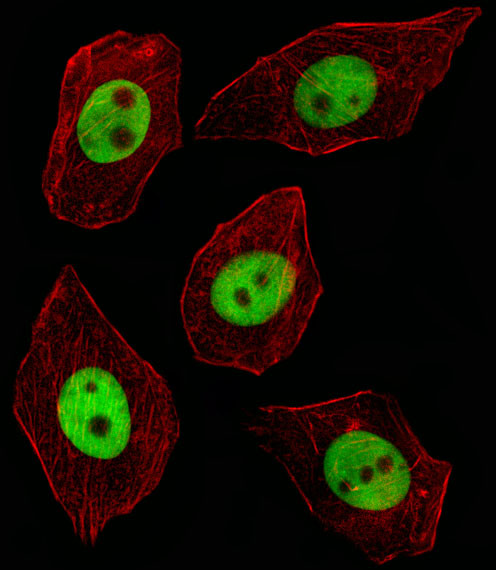 GTF2I Antibody in Immunocytochemistry (ICC/IF)