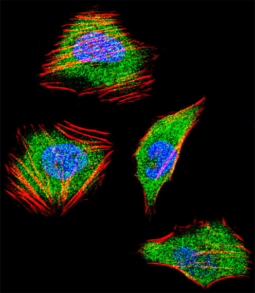 SMAD4 Antibody in Immunocytochemistry (ICC/IF)