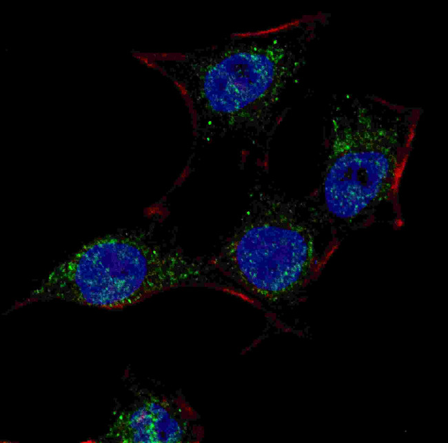 SCAP Antibody in Immunocytochemistry (ICC/IF)