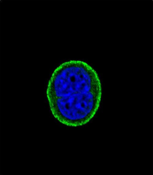 IL10RA Antibody in Immunocytochemistry (ICC/IF)