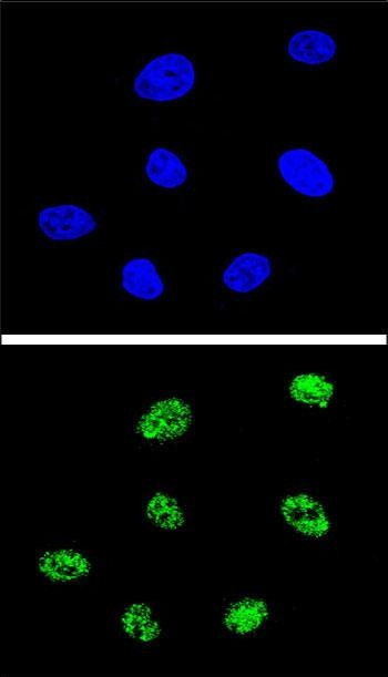 p73 Antibody in Immunocytochemistry (ICC/IF)