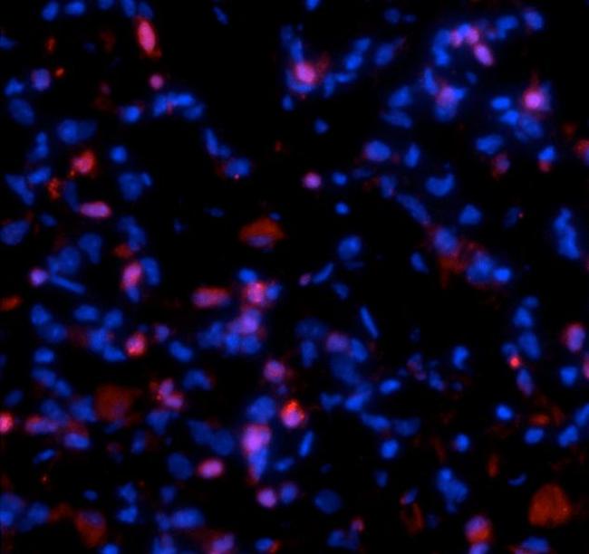 Procollagen I N-Peptide Antibody in Immunohistochemistry (IHC)