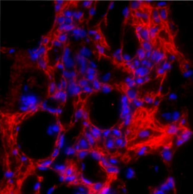 Procollagen I C-Peptide Antibody in Immunohistochemistry (IHC)