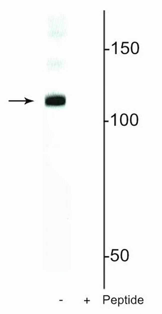 Phospho-DGCR8 (Ser377) Antibody in Western Blot (WB)