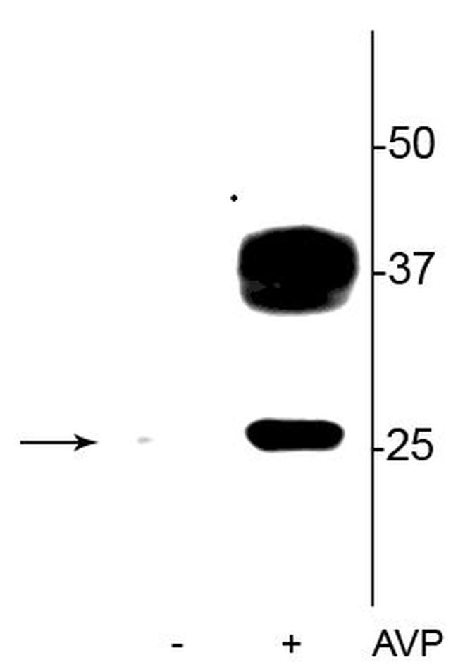 Phospho-Aquaporin 2 (Ser269) Antibody in Western Blot (WB)