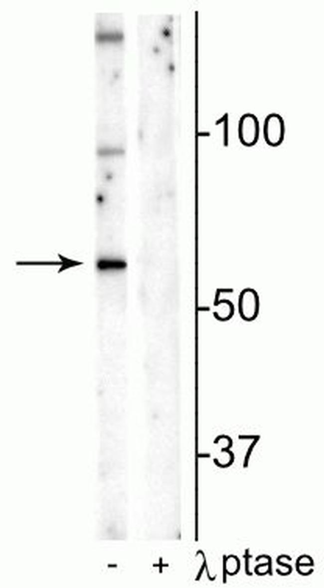 Phospho-MUNC18 (Ser241) Antibody in Western Blot (WB)