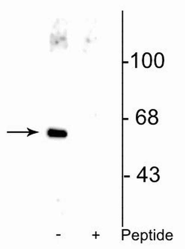 Phospho-AATF (Ser477) Antibody in Western Blot (WB)