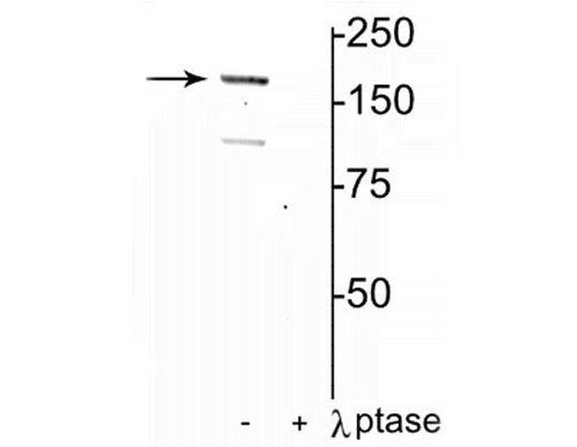 Phospho-NMDAR2A (Tyr1325) Antibody in Western Blot (WB)