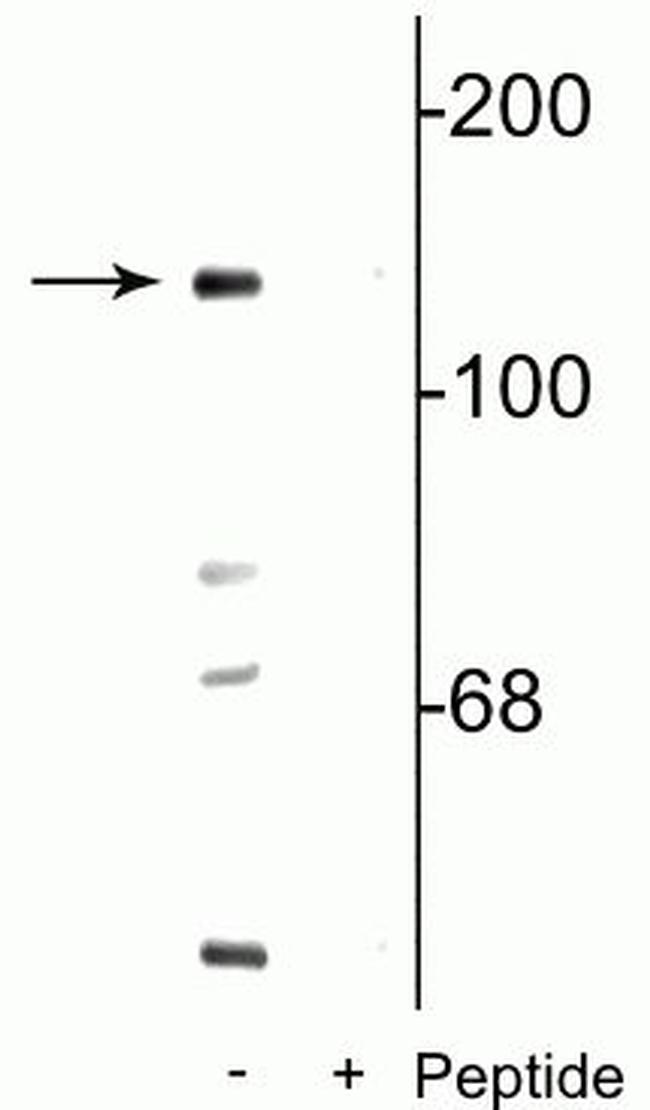 Phospho-NMDAR2C (Ser1096) Antibody in Western Blot (WB)