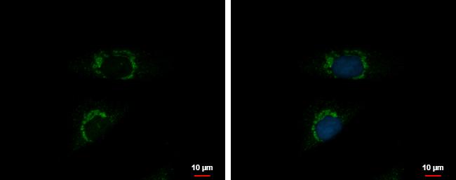 INTU Antibody in Immunocytochemistry (ICC/IF)