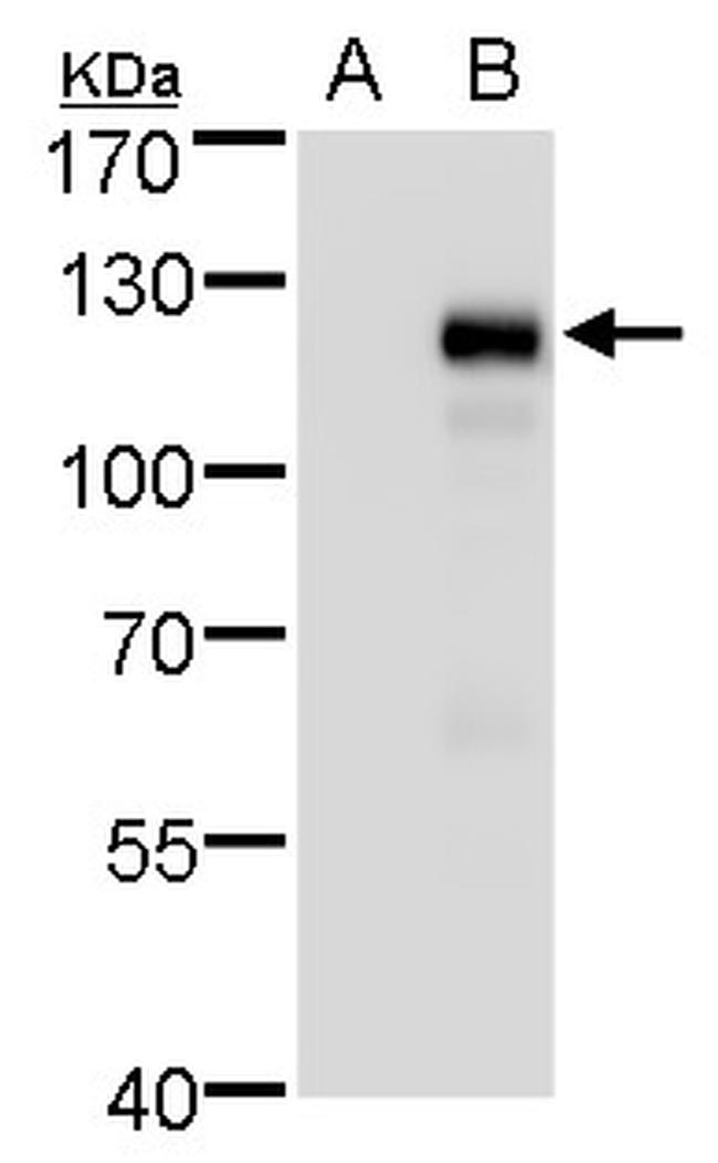 MKL1 Antibody in Western Blot (WB)