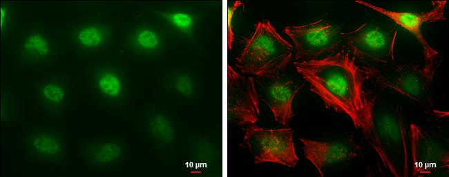 MTF2 Antibody in Immunocytochemistry (ICC/IF)