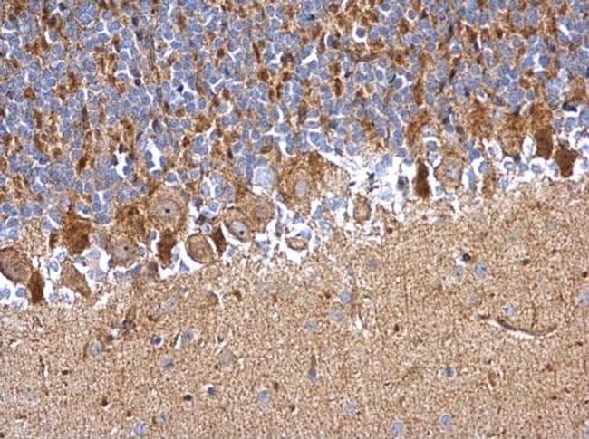 PDDC1 Antibody in Immunohistochemistry (Paraffin) (IHC (P))