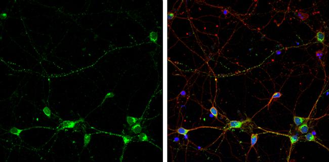 RPH3A Antibody in Immunocytochemistry (ICC/IF)