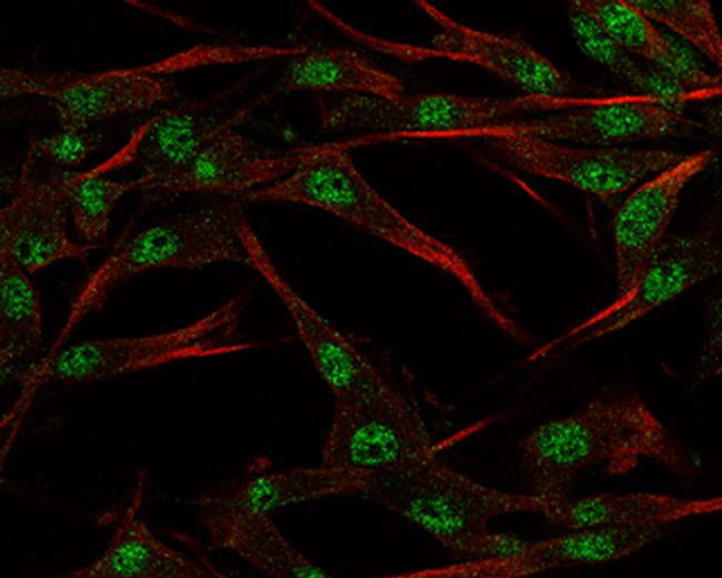 SOX3 Antibody in Immunocytochemistry (ICC/IF)