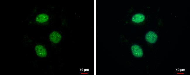 ZNF599 Antibody in Immunocytochemistry (ICC/IF)