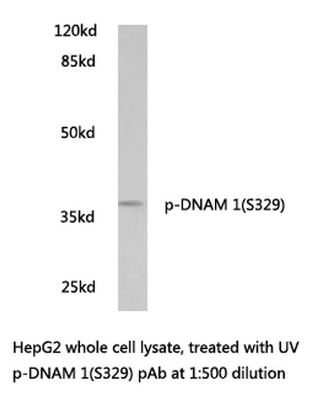 Phospho-CD226 (Ser329) Antibody in Western Blot (WB)