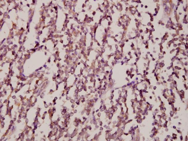 JNK1/JNK2/JNK3 Antibody in Immunohistochemistry (Paraffin) (IHC (P))