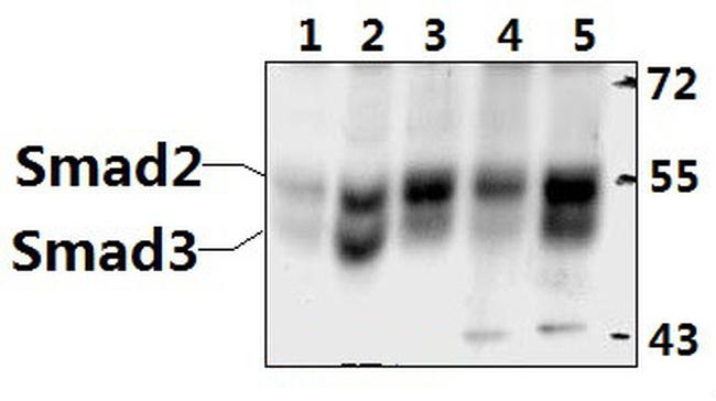 SMAD2/SMAD3 Antibody in Western Blot (WB)