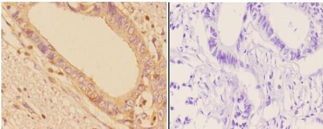 ADD1/ADD2 Antibody in Immunohistochemistry (Paraffin) (IHC (P))