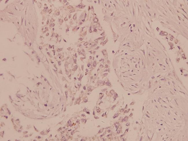 AMPK alpha-1,2 Antibody in Immunohistochemistry (Paraffin) (IHC (P))