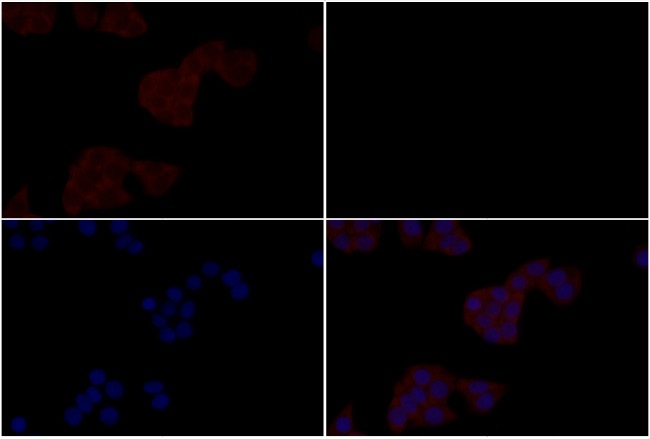 alpha Catenin Antibody in Immunocytochemistry (ICC/IF)