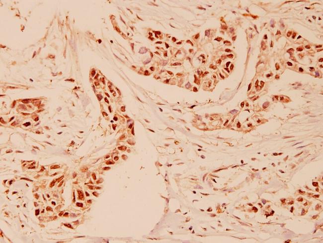 Cyclin A Antibody in Immunohistochemistry (Paraffin) (IHC (P))