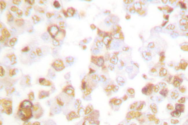 Cyclin F Antibody in Immunohistochemistry (Paraffin) (IHC (P))