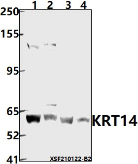 Cytokeratin 14/16 Antibody in Western Blot (WB)