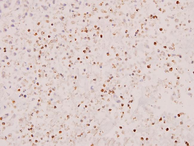 STAT5 alpha/beta Antibody in Immunohistochemistry (Paraffin) (IHC (P))