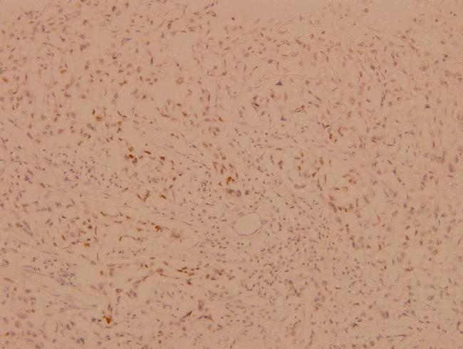 FOXO1/FOXO3/FOXO4 Antibody in Immunohistochemistry (Paraffin) (IHC (P))