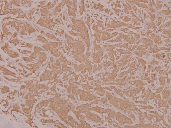 HYD Antibody in Immunohistochemistry (Paraffin) (IHC (P))