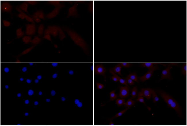 MSK1 Antibody in Immunocytochemistry (ICC/IF)