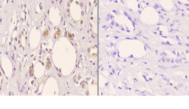 TOP3B Antibody in Immunohistochemistry (Paraffin) (IHC (P))